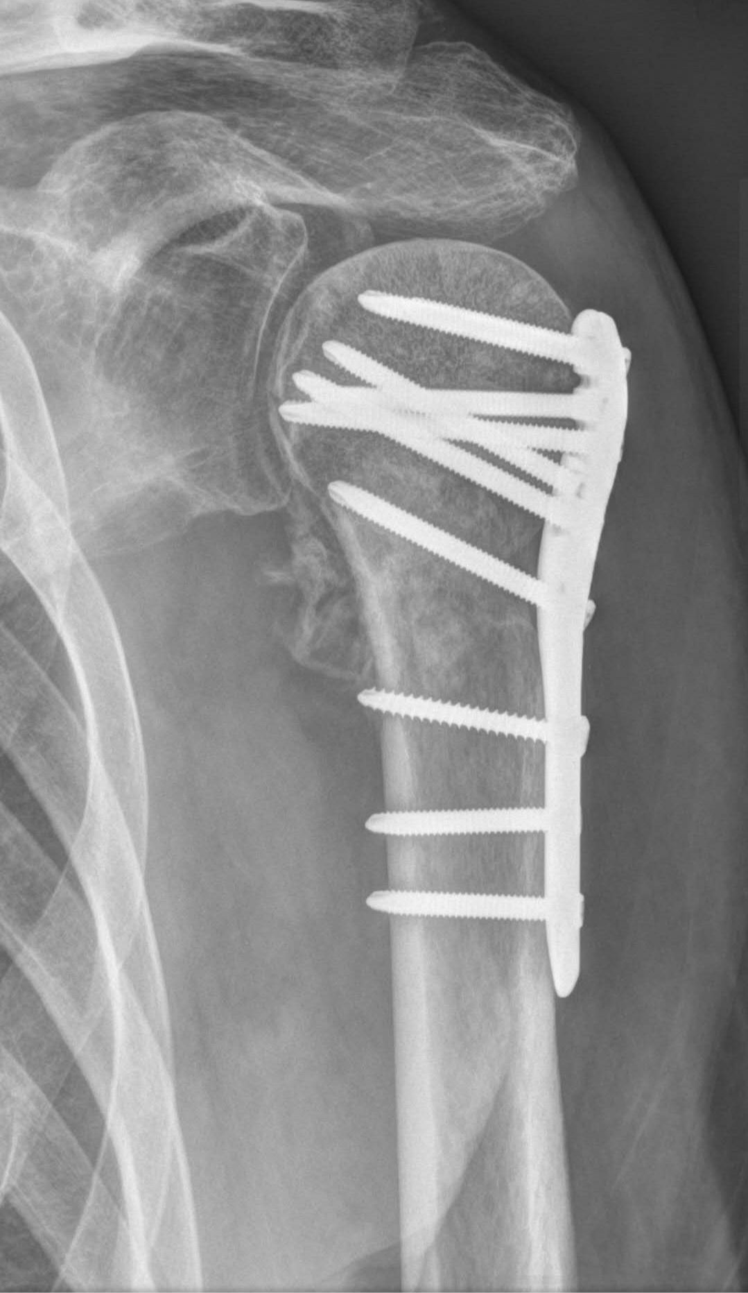 (三四十) 抽油煙機之「伏筆」